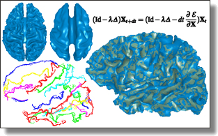 Generalized flows for brain matching